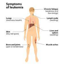 • problems with intrauterine development. Common Symptoms Of Childhood Cancer Most Common Symptoms Rxwiki