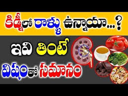 Home Remedies For Kidney Stones Renal Caliculi In Telugu Dr Krishna Youtube Invoice Template Word Home Remedies Kidney Stones Remedy