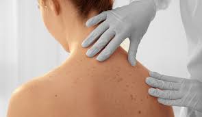 Metastatic skin lesions may originate from melanoma, breast, lung, colon, and various other types of cancer. Skin Cancer Causes Types Treatment And Removal