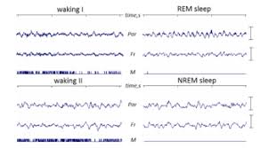 Rapid Eye Movement Sleep Wikipedia