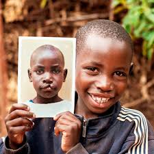 Mossoró recebe mutirão de cirurgias gratuitas para pacientes com fissura  labiopalatina