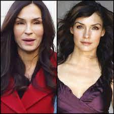 She's aged 15+ years in less than 3. Nooooo She Used To Be So Pretty Famke Janssen Botchedsurgeries
