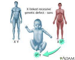 Duchenne Muscular Dystrophy Information Mount Sinai New York