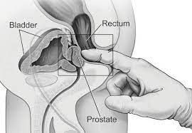 Male G Spot | Sex Pictures Pass