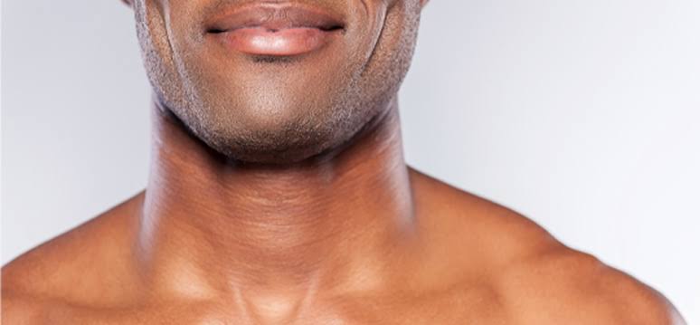 Chin Harmonization