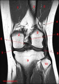 Knee anatomy francesc malagelada jordi vega pau golanó the knee is the largest joint in. Atlas Of Knee Mri Anatomy W Radiology