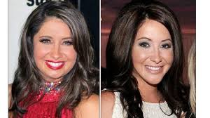 What happened to Bristol Palin's face?!