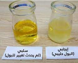 ما مدى دقة تحليل الحمل بالملح سالوبيت