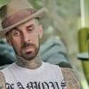 Travis barker has opened up in detail about the plane crash that almost took his life, showing the world the gruesome photos of injuries that almost killed him. 3