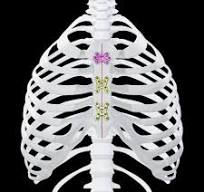 MatrixSTERNUM™ Fixation System