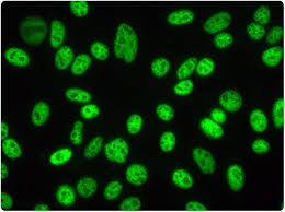 Image result for ANA Staining Pattern