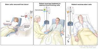 Testicular Cancer Treatment (Pdq®)–Patient Version - Nci