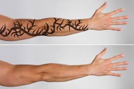 Maybe you would like to learn more about one of these? Laser Tattoo Removal How Long Does It Take To See Results