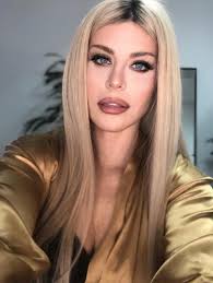 Fotografia a iscat o serie de reacții printre fani. Loredana Groza È™i A FÄƒcut Iar OperaÈ›ii Estetice Cum AratÄƒ Vedeta Acum Observatorul Prahovean