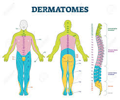 It consists of a sequence of vertebrae (singular = vertebra), each of which is separated and united by an intervertebral disc. Dermatomes Vector Illustration Labeled Educational Anatomical Skin Parts Scheme Epidermis Area Supplied By Afferent Spinal Nerve Fibers Cervical Thoracic Lumbar And Sacral Nerves Division Diagram Royalty Free Cliparts Vectors And Stock Illustration