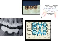 test dental charting quizlet