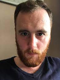A's beat writer for the san francisco chronicle. 6 6 27m High Hairline And Bad Facial Symmetry Unwashed And Ungroomed In This Pic Truerateme