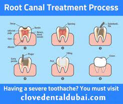 Pin On Clove Stuff C Love Your Teeth