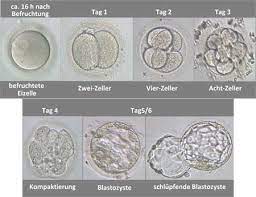Der embryo nimmt in dieser phase bereits nährstoffe auf und beginnt, sich zu entwickeln und zu entwicklung beim embryo: Ablauf Der Kunstlichen Befruchtung Kinderwunsch At