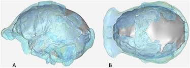 ''neo'' skull of homo naledi. Homo Naledi Wikiwand