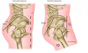 Jeg har ikke hatt operative inngrep. Den Virkelige Losningen Pa Dine Ryggsmerter Msk Neurology