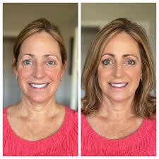 Selena Gomez Wonder Beauty Without Makeup Starreallife #starreallife  #selenagomez #selena #selenagomezedits #selenagomezfans #pink #bennyblanco  #singer #taylorswift #TaylorSwiftFans #Priyankachopra #nickjonas  #arielwinter #aishwaryarai #british #paris ...