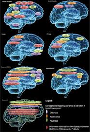 Autism is a developmental disorder of the brain. Autism Spectrum Disorders A Meta Analysis Of Executive Function Molecular Psychiatry
