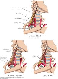 Anterior Scalene Muscle Anatomy And Physiology Print Muscle