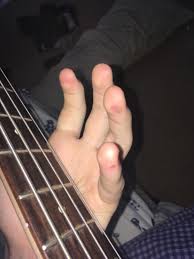 Although it has similar features with guitars, mastering it requires a lot of effort. How Much Longer Will I Be Getting These Blisters On My Hands From Playing Bass I Ve Been Playing For About A Month And I M Unable To Play With These Bassguitar