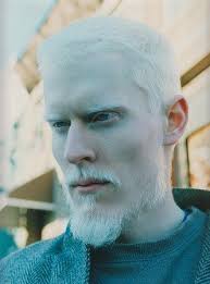 His modeling career started in givenchy's cult spring/summer 2011 campaign and shot a controversial editorial with w magazine. Givenchy Model Albino Iucn Water