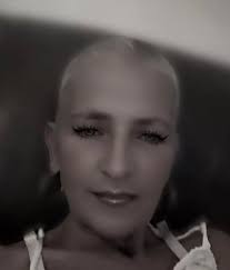 How to stop hair shedding due to malnutrition and low iron storage?