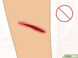 Vergleiche preise für orajel deutschland und finde den besten preis. Orajel Auftragen Wikihow