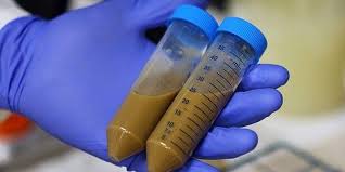 Image result for Fecal Transfer