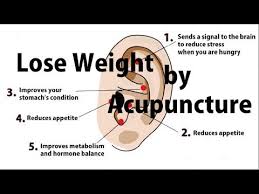 Pin On Auriculotherapy