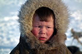 DHA Bahaya Bagi Anak Jika Berlebih, Bisa Timbulkan Perdarahan di Kulit