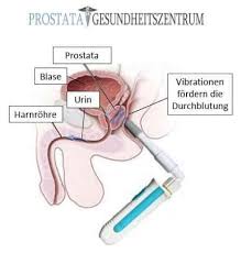 What is prostate massage exactly? Prostatamassage Was Ist Das Und Was Bringt Es Mit Anleitung Mehr Sperma