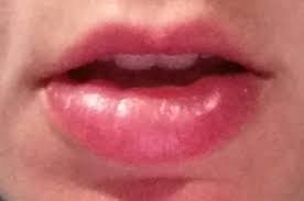 Image result for Oncinotis