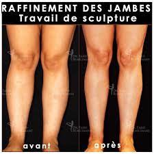 Limite d'extension pour un allongement total. Chirurgie Et Medecine Esthetique Casablanca Maroc Clinique Benslimane Publicaciones Facebook