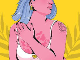 Maybe you would like to learn more about one of these? Breast Eczema Symptoms Causes Treatment And Prevention