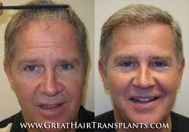 Hair Problems And Treatment For Men And Women in Texas Hidalgo McAllen