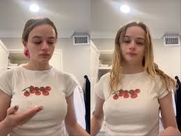 Joey King reveals she struggles with perioral dermatitis | The Independent