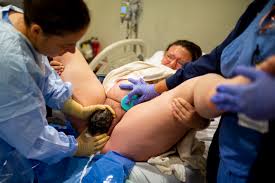 A contraction is simply the the force of contractions and pushing efforts will help the baby get into the right position to move down. Baby Crowning