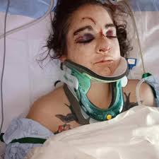 Fundraiser for Justine Michael by Katt Silvas : Support Gypsy's Healing  Journey