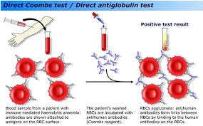 Pin On Hematologie