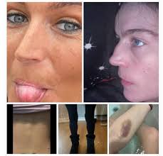 Veteran shares experiences at TC Hill in Vietnam