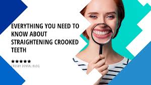 Check spelling or type a new query. Everything You Need To Know About Straightening Crooked Teeth