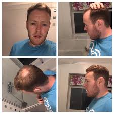 Hairstyle tips for bald spots, thin fronts and parts! Crown Bald Spot Time To Go Thoughts Bald