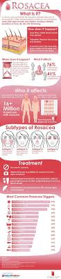 Infographic What Causes Rosacea Newdermamed Cosmetic And Advanced Laser Clinic In Downtown Toronto Offers Onl What Causes Rosacea Rosacea Treatment Rosacea