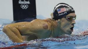 Aug 08, 2016 · the marks, spotted on a number of olympians, are the result of the holistic healing technique of cupping. Michael Phelps Purple Blotches Spotlight Cupping Trend