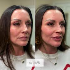 Beautify Medical Spa added a new...